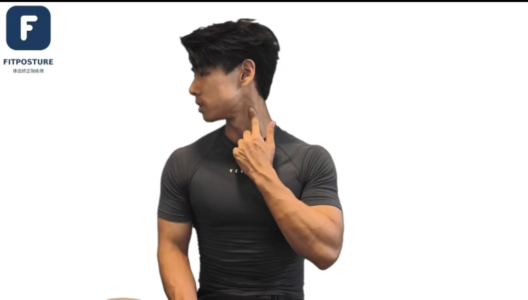 胸锁乳突肌筋膜松解